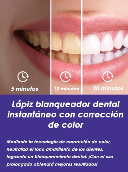 Purple Instant Teeth Whitening Pen Tartar Toothpaste Clean Teeth Stains No Sensitivity for Clearer Brighter Smile Cavity Care bd